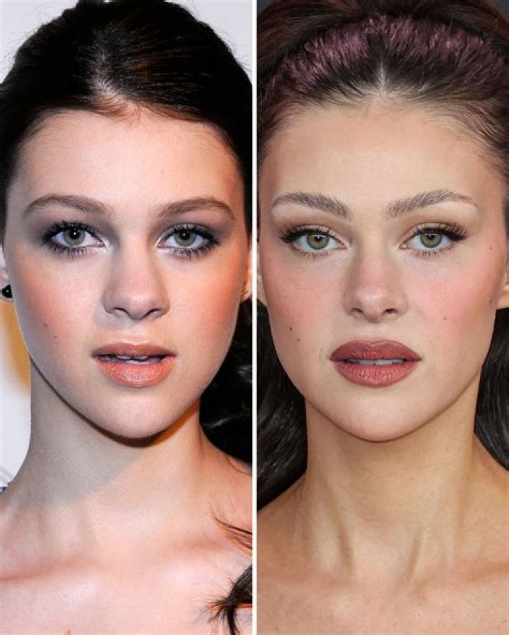 Has Nicola Peltz Had Plastic Surgery?